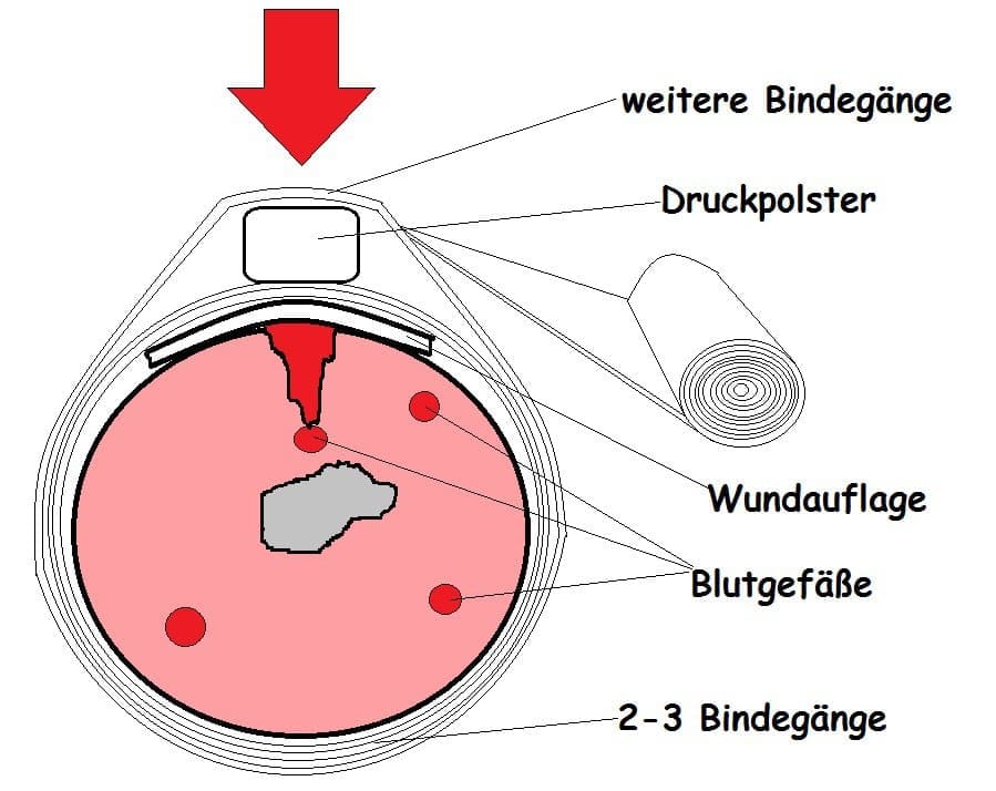 Druckverband