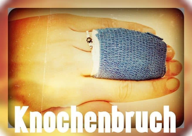 Knochenbrüche