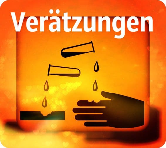 Verätzungen